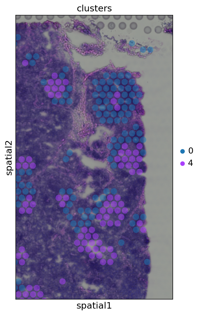 ../_images/notebooks_VisiumSpatialTranscriptomics_27_0.png